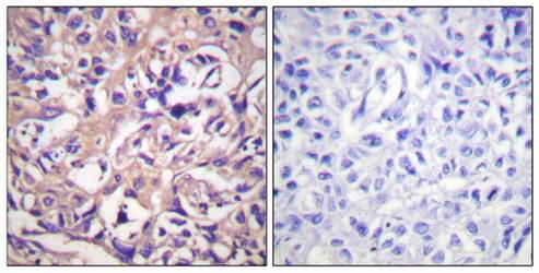 TK (Ab-13) Antibody