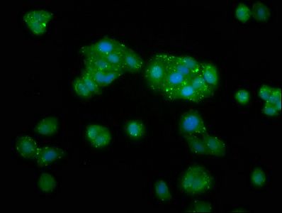 TKFC antibody