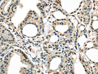 TKT Antibody