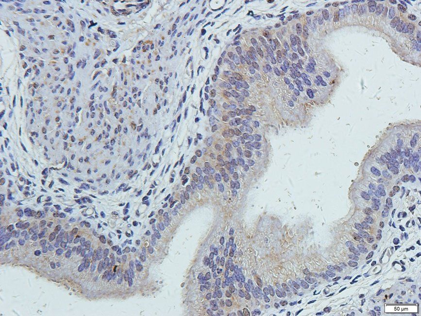 TKTL1 antibody