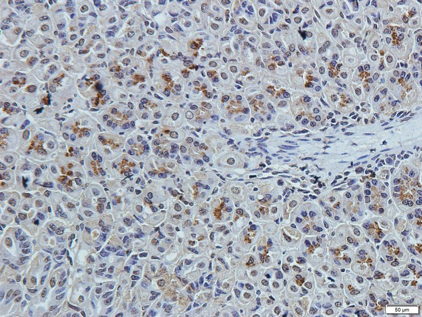 TKTL1 antibody