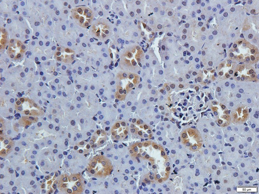 TKTL1 antibody