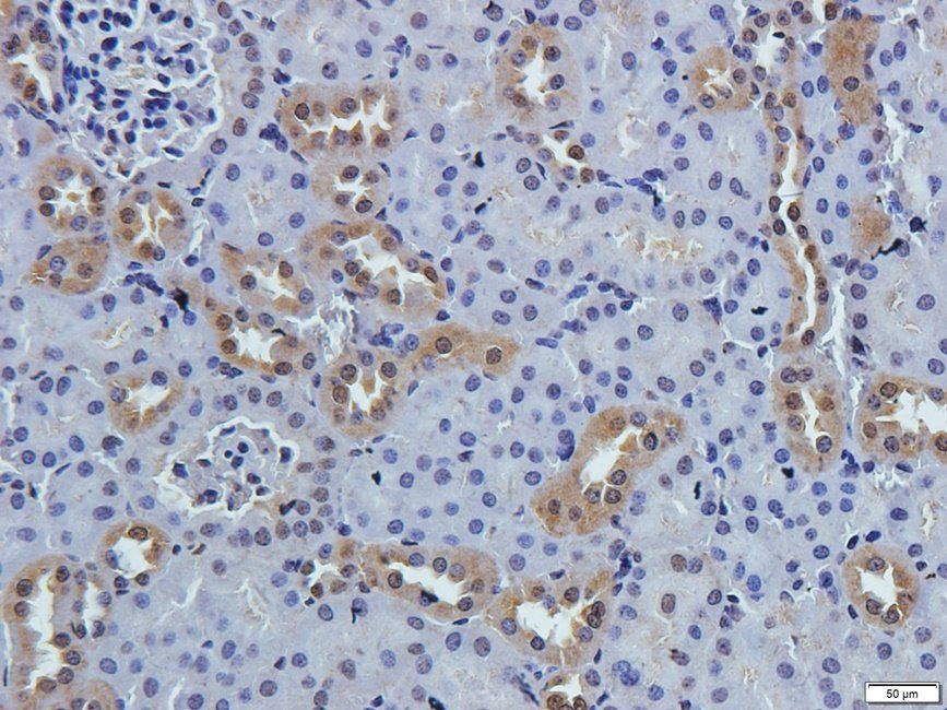 TKTL1 antibody