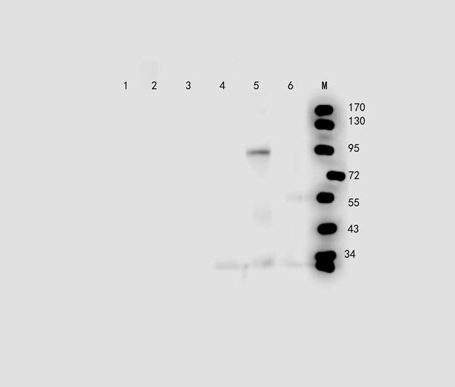 TKTL1 antibody