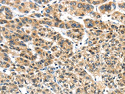 TKTL1 Antibody