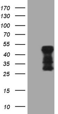 TLK2 Antibody