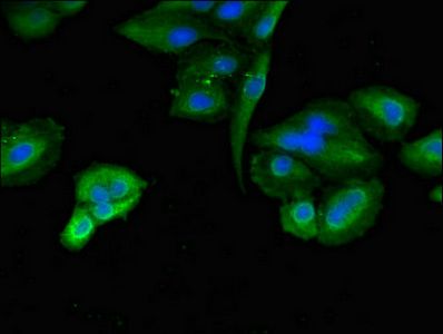 TLK2 Antibody