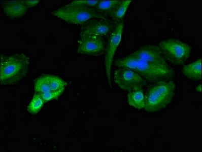 TLK2 antibody