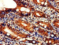 TLK2 Antibody