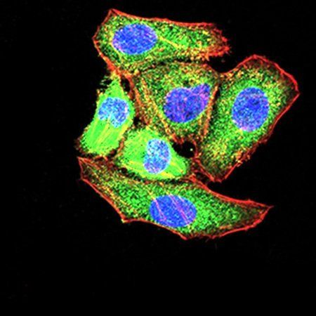 Tlr2 Antibody