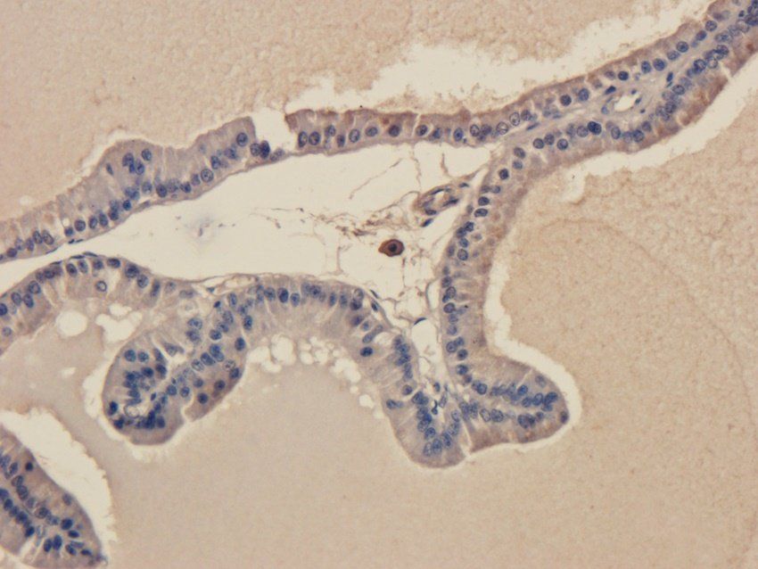 TLR2 antibody