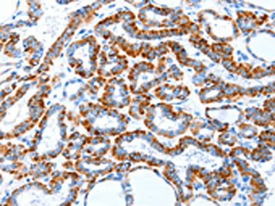 TLR2 Antibody