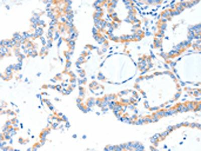 TLR2 Antibody