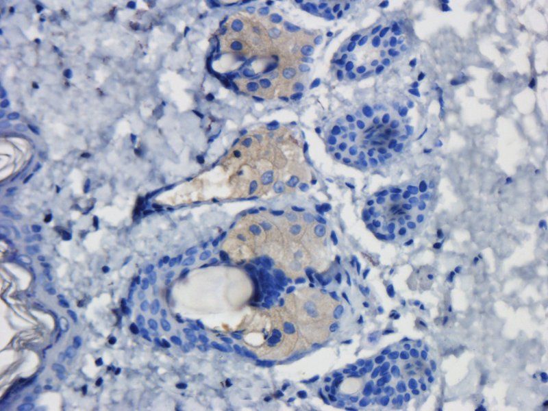 TLR2 antibody