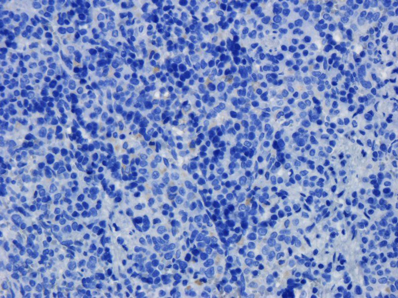 TLR2 antibody