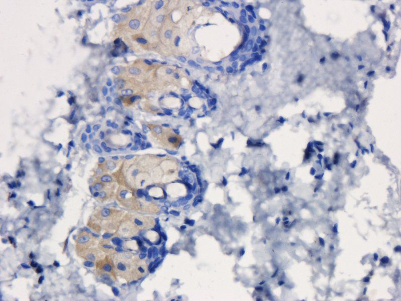 TLR2 antibody