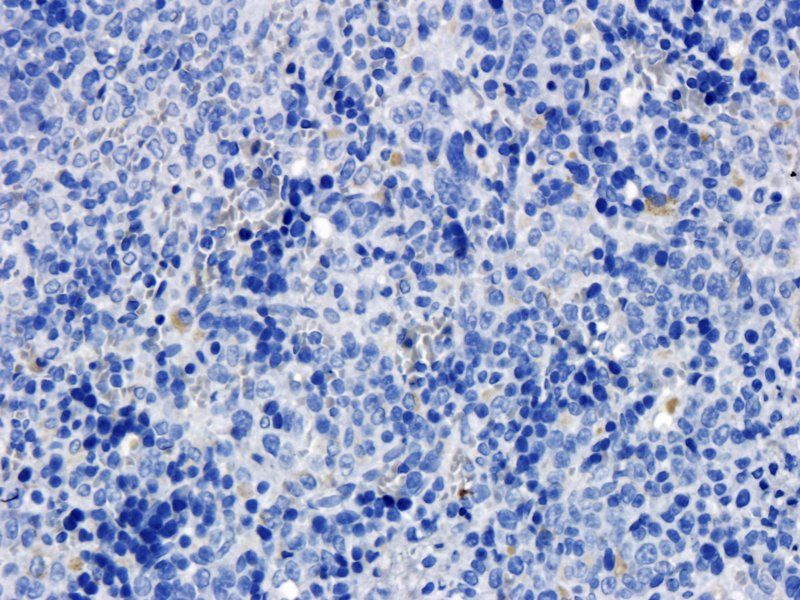 TLR2 antibody