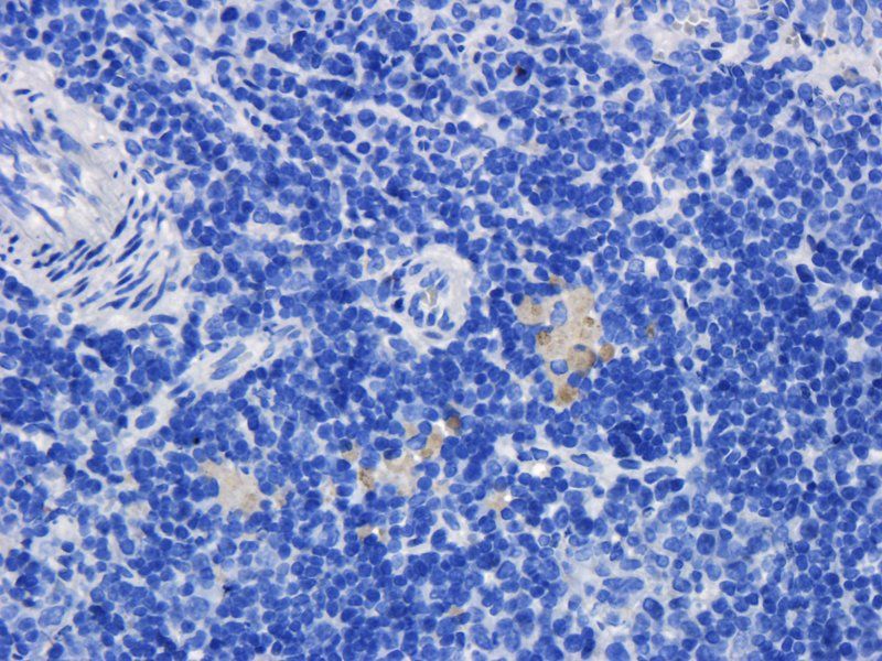 TLR2 antibody