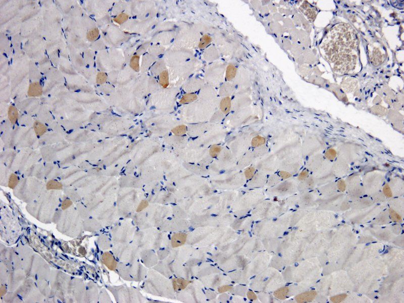 TLR2 antibody