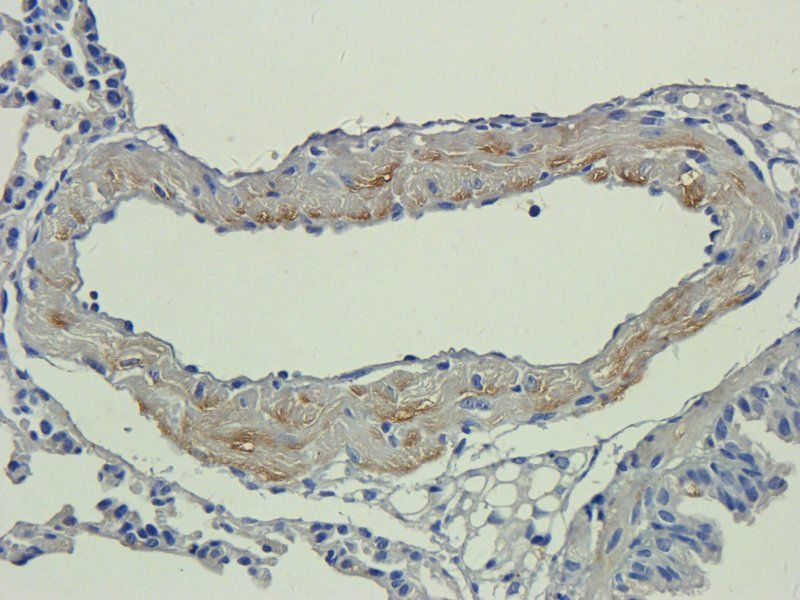 TLR2 antibody