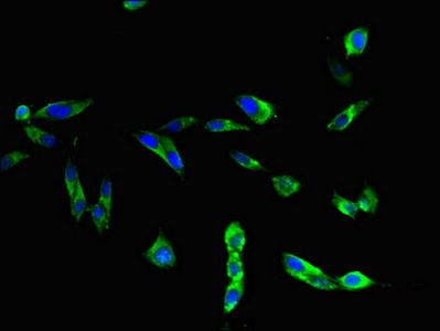 TLR3 antibody