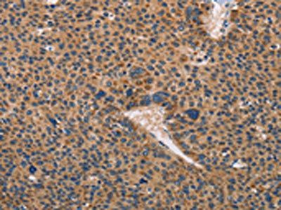 TLR3 Antibody