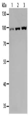 TLR3 antibody