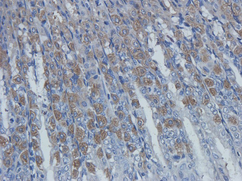 TLR4 antibody