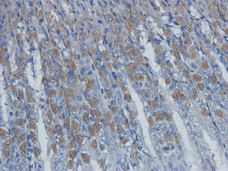 TLR4 antibody