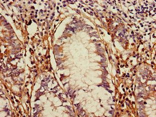 TLR5 Antibody