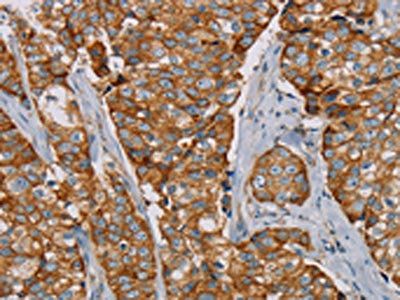 TLR6 Antibody
