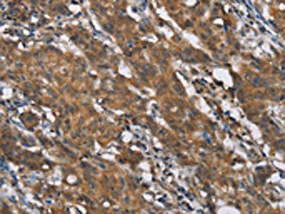 TLR6 Antibody