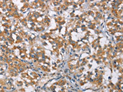 TLR6 Antibody