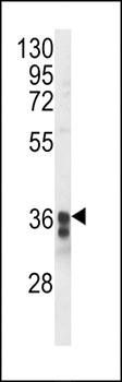TM173 antibody