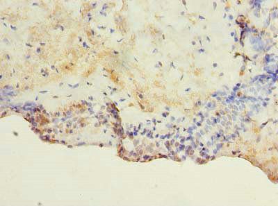 TM4SF1 Antibody