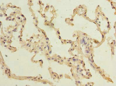 TM4SF1 Antibody