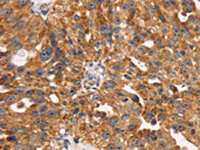 TM4SF1 Antibody