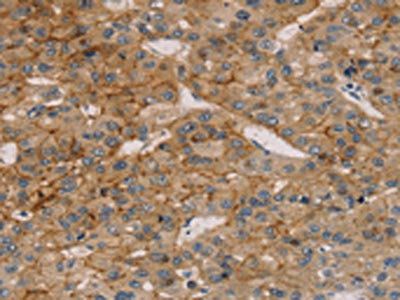 TM4SF1 Antibody