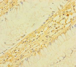 TM4SF5 Antibody