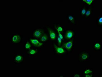 TM6SF2 Antibody