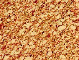 TM6SF2 Antibody