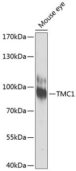 TMC1 antibody