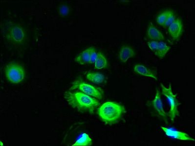 TMCO5A Antibody