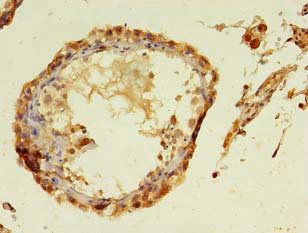 TMCO5A Antibody