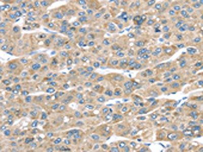 TMED2 Antibody