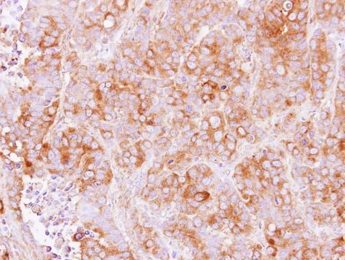 transmembrane p24 trafficking protein 2 Antibody