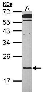 TMED2 antibody [N1C3-2]