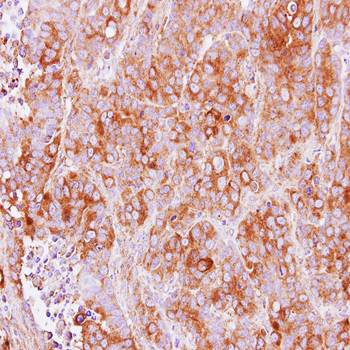 TMED2 Rabbit Polyclonal Antibody