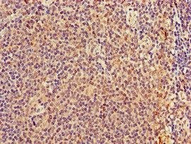 TMEM11 antibody