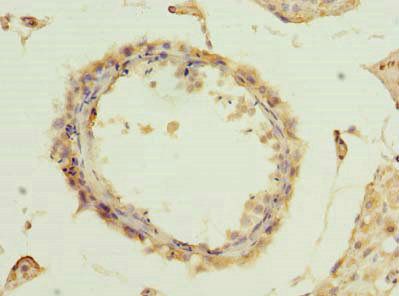 TMEM115 antibody